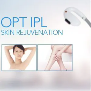 HiTechBeauty - OPT SHR E-Light (RF & IPL) Hair Removal & Skin Rejuvenation Machine - 500K shots - Image 3