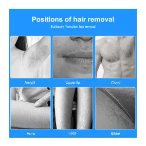 HiTechBeauty - OPT SHR E-Light (RF & IPL) Hair Removal & Skin Rejuvenation Machine - 500K shots - Image 8