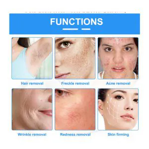 HiTechBeauty - OPT SHR E-Light (RF & IPL) Hair Removal & Skin Rejuvenation Machine - 500K shots - Image 9