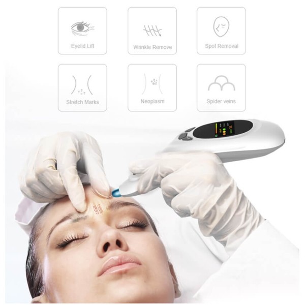 HiTechBeauty - Plasma Pen (Spot Plasma, Fractional, Lifting, Permeating) - Image 2