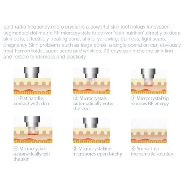 Fire & Ice RF Micro Needling MicroDerma machine with cold hammer (Gold Standard) - Image 6