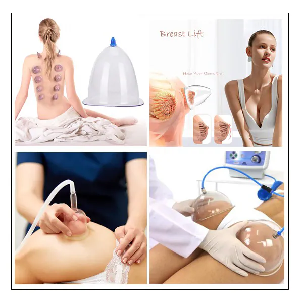 Dry Cupping - Stomach (60 min)